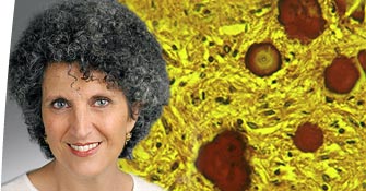 Alessandra d'Azzo, PhD