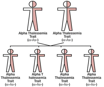 Alpha Thalassemia Symptoms