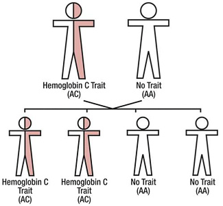 Sickle Hemoglobin