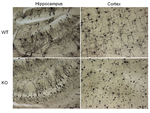 Golgi staining of br ain regions from WT and KO ß-galactosidase deficient mice.
Meganeurites, abnormal dendrites and reduction in the number of neurons are evident in the KO sections