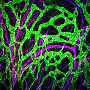 lymphatic system (anatomy) : Bone marrow.