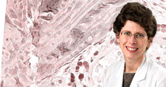 Melissa M. Hudson, MD