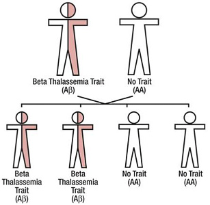 cooley anemia