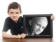 Brennan Simkins