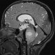 Brain scan