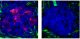 tumor suppressor protein PTEN