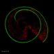 cochlea