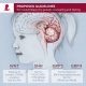 Infographic: Proposed guidelines for medulloblastoma genetic counseling and testing