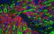 Endothelial progenitor cells expanding and proliferating forming rhabdomyosarcoma tumors
