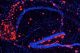 B-amyloid in brains that is LANDO-deficient