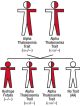 Alpha thalassemia trait - cis both parents
