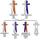 Hemoglobin D / Beta Zero Thalassemia Disease