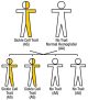 Sickle Cell Trait