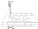 Illustration of reclining position with epidural catheter