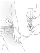 Vent tube drawing