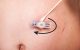 Clean around feeding tube
