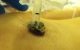 Granulation tissue