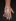 Hand with PIV