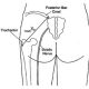 Injection site buttocks