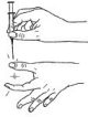 Hold syringe like a dart