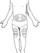 Injection sites