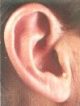 CIC hearing aid