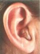 ITC hearing aid
