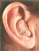 ITE hearing aid