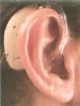 BTE hearing aid