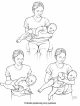 Torticollis