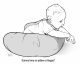 Torticollis