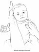 Torticollis