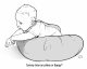 Torticollis