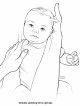 Torticollis