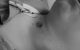 Check the stoma