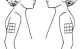 Injection sites