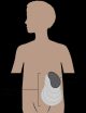 El bazo es un órgano que se encuentra en el lado izquierdo de su cuerpo, debajo de las costillas.