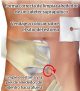 Necesita limpiar el tubo del catéter y el orificio por donde ingresa al abdomen. Siga estos pasos para limpiar el estoma, o el orificio de ingreso.
